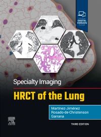 Specialty Imaging: HRCT of the Lung