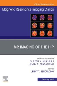 MR Imaging of the Hip, An Issue of Magnetic Resonance Imaging Clinics of North America