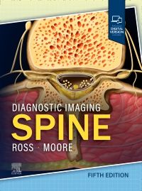 Diagnostic Imaging: Spine