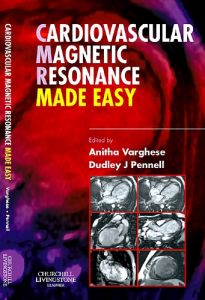 Cardiovascular Magnetic Resonance Made Easy