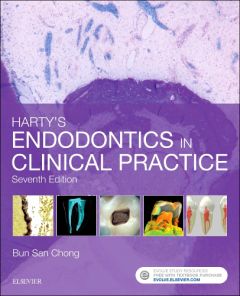 Harty's Endodontics in Clinical Practice E-Book