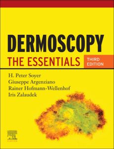 Dermoscopy E-Book