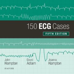 150 ECG Cases