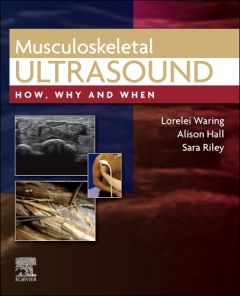 Musculoskeletal Ultrasound, Elsevier E-Book on VitalSource