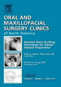 Alveolar Bone Grafting Techniques in Dental Implant Preparation, An Issue of Oral and Maxillofacial Surgery Clinics