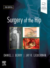 Surgery of the Hip: 2nd edition | Daniel J. Berry | ISBN 