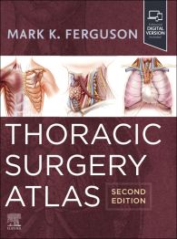 K Eckland – Thoracic Surgery