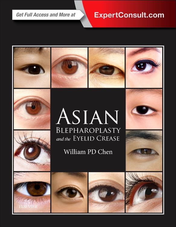 asian eyelid anatomy