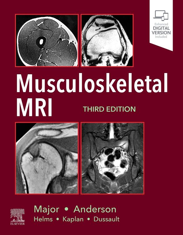 Musculoskeletal MRI: 3rd Edition | Nancy M. Major | ISBN: 9780323415606 ...