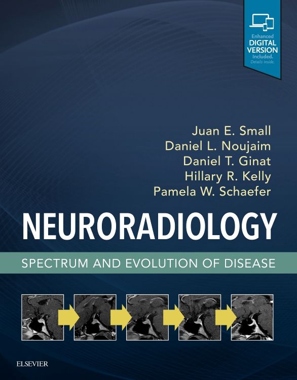 Neuroradiology Spectrum and Evolution of Diseas 1st edition