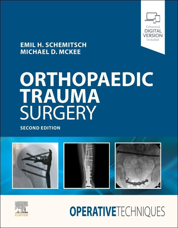 Operative Techniques: Orthopaedic Trauma Surgery: 2nd edition | Emil ...