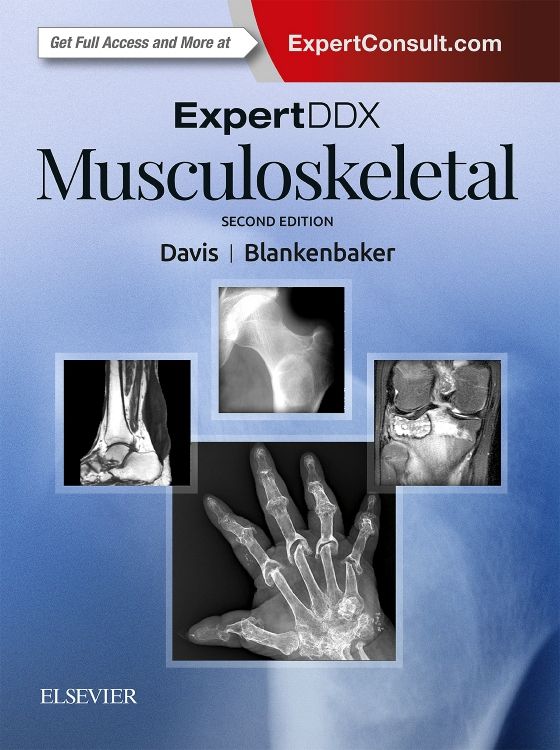 ExpertDDx: Musculoskeletal: 2nd edition | Kirkland W. Davis | ISBN:  9780323524834 | Elsevier Asia Bookstore