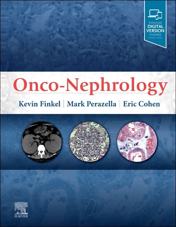 Onco-Nephrology: 1st Edition | Kevin W. Finkel | ISBN: 9780323549455 ...