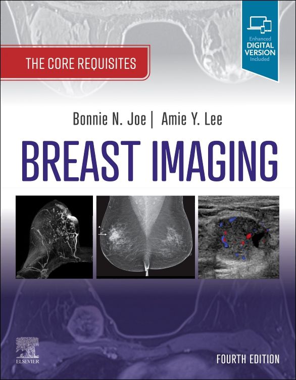 Breast Imaging: 4th edition, Bonnie N. Joe
