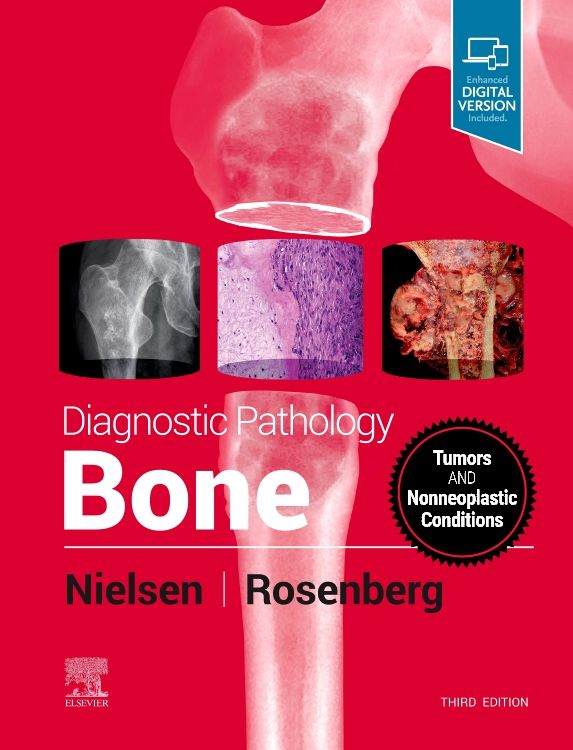 Diagnostic Pathology: Bone: 3rd edition | G. Petur Nielsen | ISBN:  9780323765336 | Elsevier Asia Bookstore