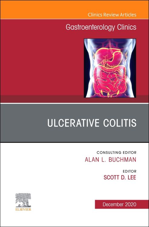 Clinical review of ulcerative colitis: epidemiology, diagnosis and  management