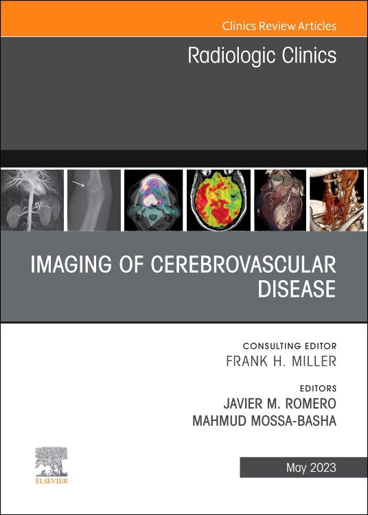 Imaging of Cerebrovascular Disease, An Issue of: 1st edition | Edited ...