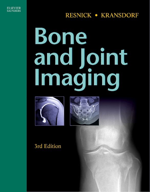 Evolve Resources for Bones and Joints, 7th Edition - 9780702075384