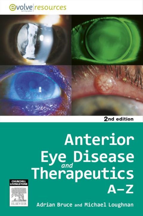 Anterior Eye Disease and Therapeutics A-Z - E-Bo: 2nd edition | Adrian S.  Bruce | ISBN: 9780729579575 | Elsevier Asia Bookstore