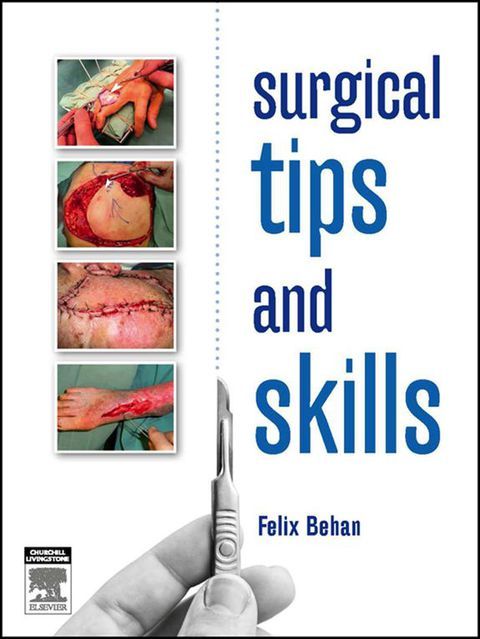 Surgical Tips And Skills - EBook: 1st Edition | Felix Behan | ISBN ...