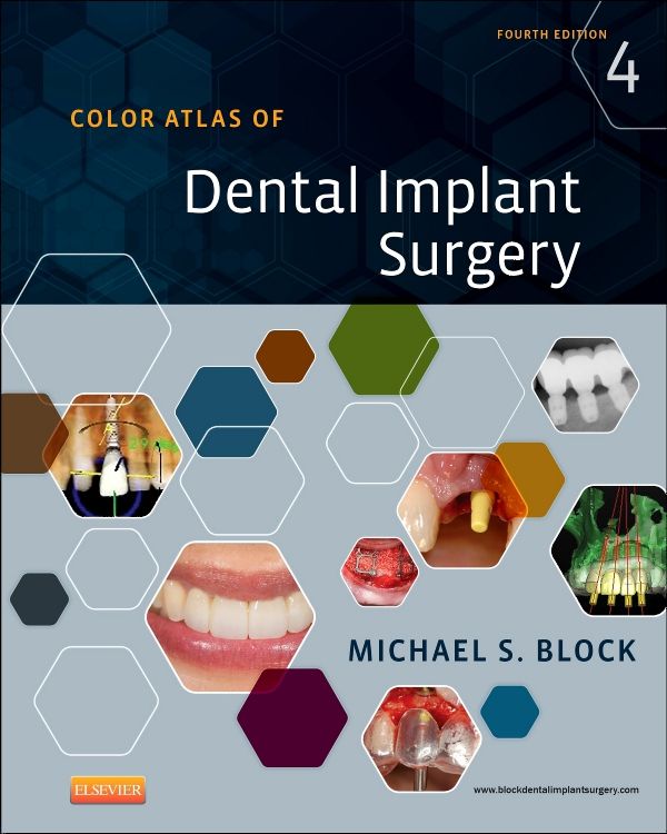 Color Atlas of Dental Implant Surgery 4th edition Michael S. Block