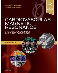 Cardiovascular Magnetic Resonance