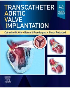 Transcatheter Aortic Valve Implantation