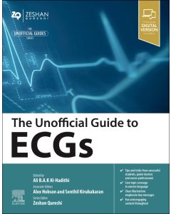 The Unofficial Guide to ECGs