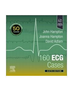 160 ECG Cases