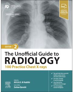 The Unofficial Guide to Radiology: 100 Practice Chest X-rays