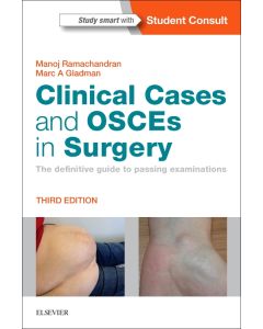 Clinical Cases and OSCEs in Surgery